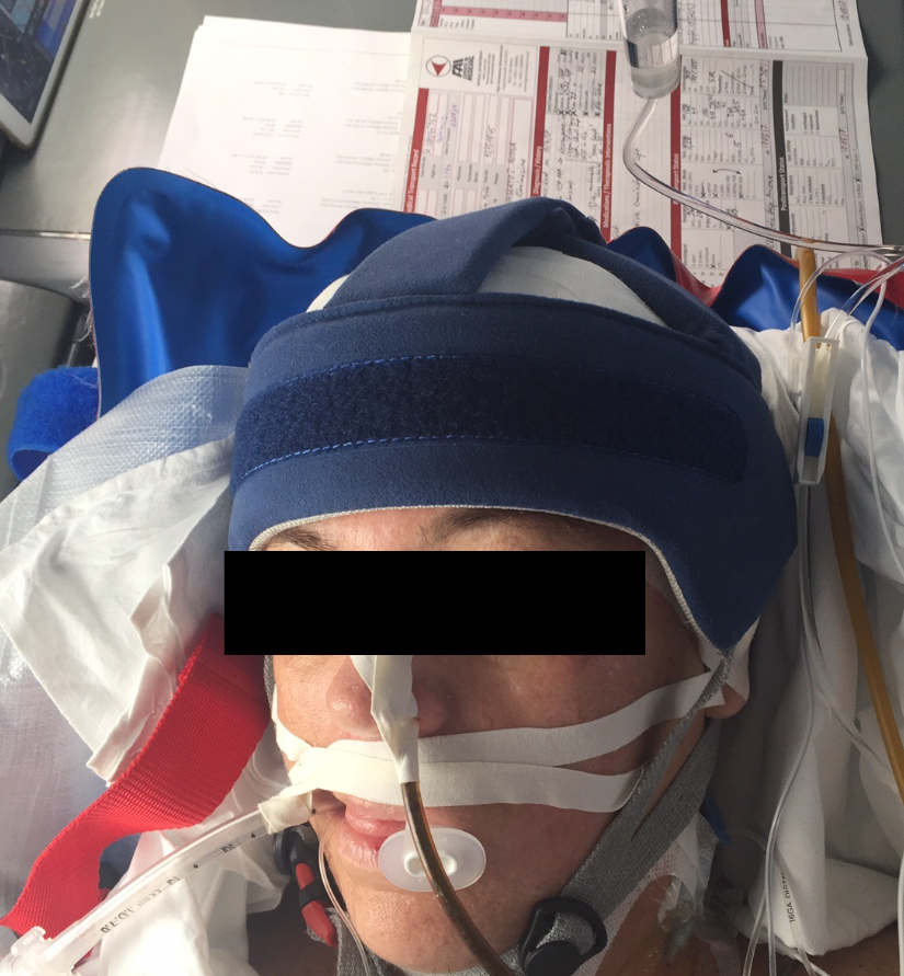 Transporting patients after a craniectomy AirMed&Rescue