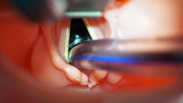 patient airway training