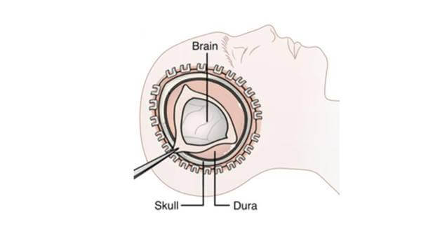 Brain diagram