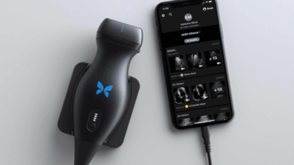 Butterfly IQ scanner