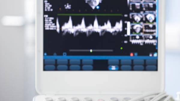 ultrasound 2
