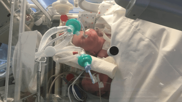 Baby in medical bed