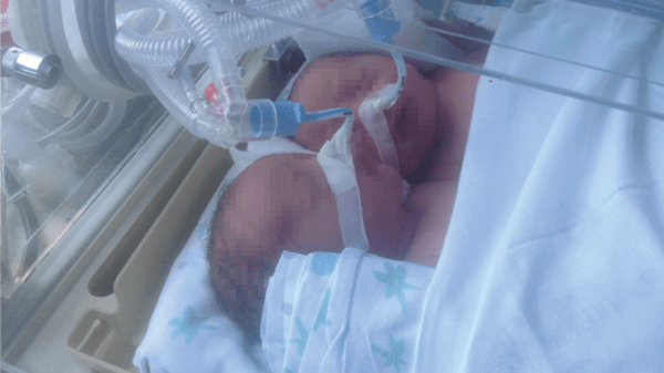 Baby in medical bed