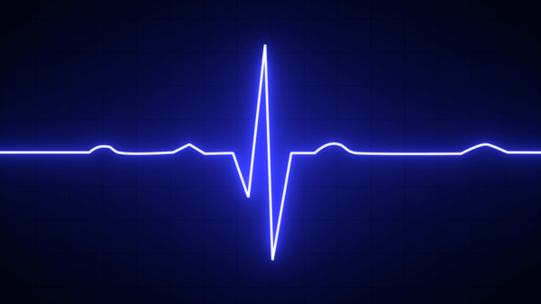 Heart monitor line
